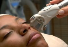 How Can You Treat Melasma? Treat Melasma