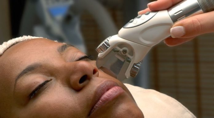 How Can You Treat Melasma? Treat Melasma