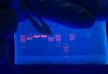 How to Read Gel Electrophoresis Bands Gel Electrophoresis Bands
