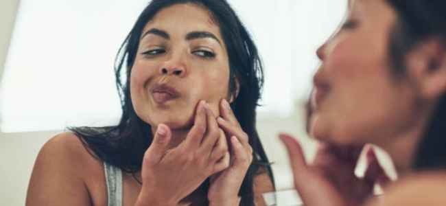 Which Treatment is Best for Pimples Which Treatment is Best for Pimples
