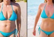 Method For Coolsculpting Method For Coolsculpting