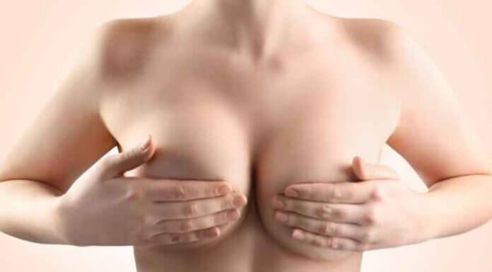 The Ultimate Guide to the Anchor Breast Lift The Ultimate Guide to the Anchor Breast Lift