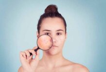 Dealing With Acne: What Not To Do, Preventing Acne And How To Treat Them Dealing With Acne