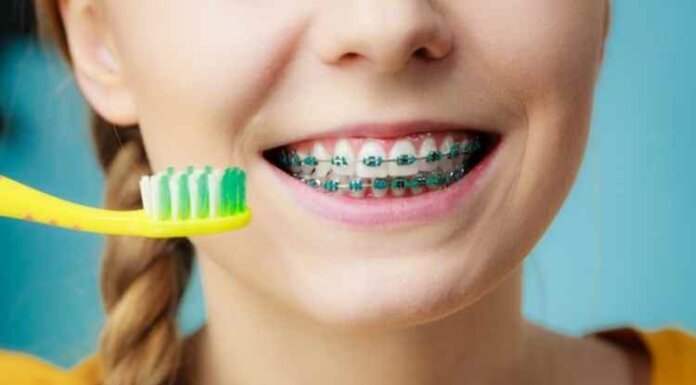 Braces for Kids: What Is the Best Age for Your Child to Get Braces? What Is the Best Age for Your Child to Get Braces