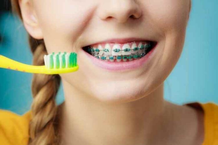 What Is the Best Age for Your Child to Get Braces