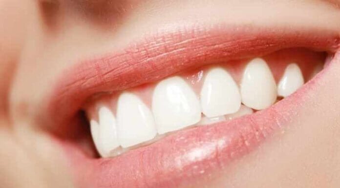 The Complete Guide on How to Get Perfect Teeth The Complete Guide on How to Get Perfect Teeth