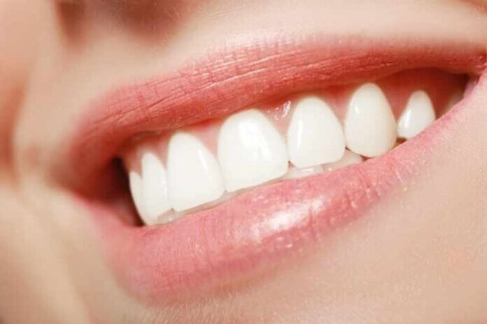 The Complete Guide on How to Get Perfect Teeth