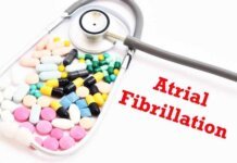 What Are the Signs and Symptoms of Atrial Fibrillation? What Are the Signs and Symptoms of Atrial Fibrillation
