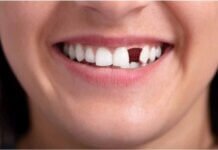 What Can You Do About Missing Teeth? A Quick Guide What Can You Do About Missing Teeth? A Quick Guide