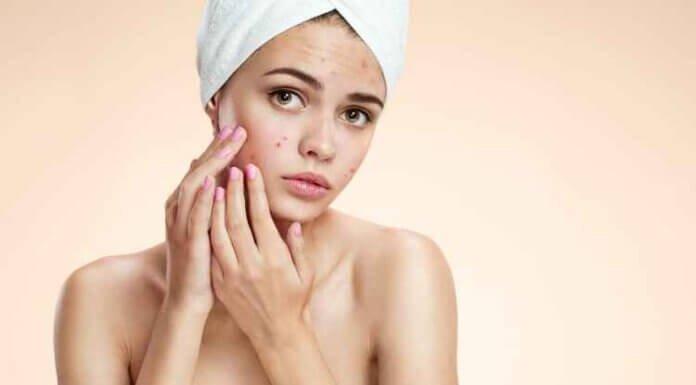 How To Remove Tan From Face Immediately At Home How To Remove Tan From Face Immediately At Home