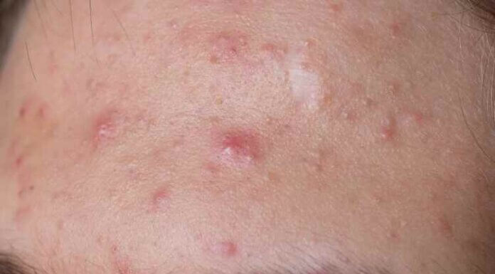 How To Make Your Forehead Look Smaller? Tips and details Forehead Look Smaller